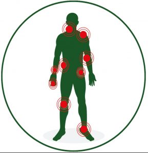 ZONES D'APPLICATION EN USAGE EXTERNE : Cou, Dos, Épaules, Coudes, Articulations, Muscles, etc.